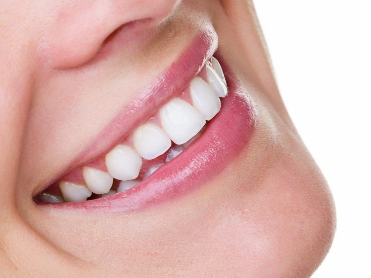 Sonrisa con dientes blancos de cerca (imagen ilustrativa)