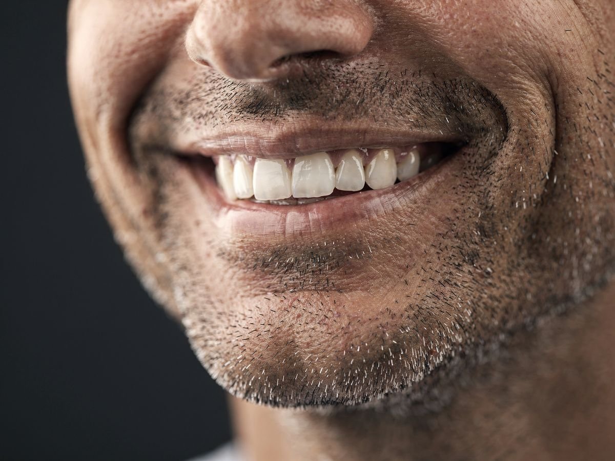Sonrisa natural de un adulto (imagen ilustrativa)