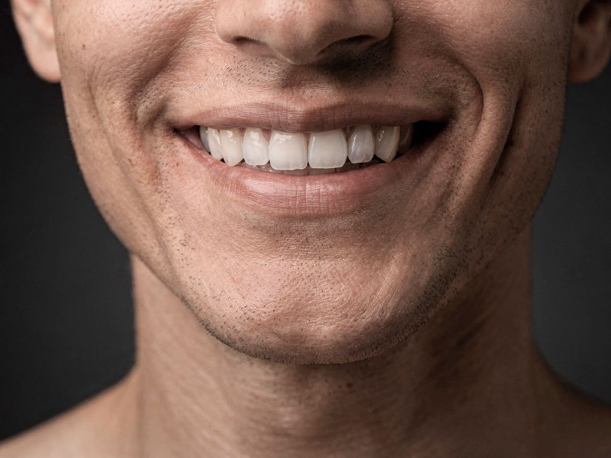 Sonrisa limpia después de una profilaxis (imagen ilustrativa)