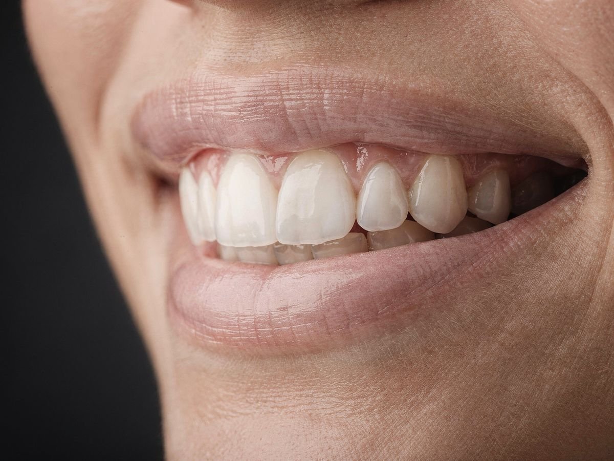 Encías sanas y dientes limpios (imagen ilustrativa)